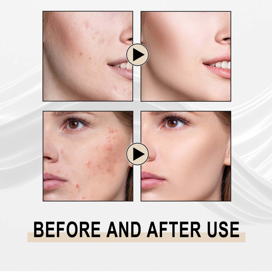 Lactobionic Acid Serum for Smoother-Looking Pores