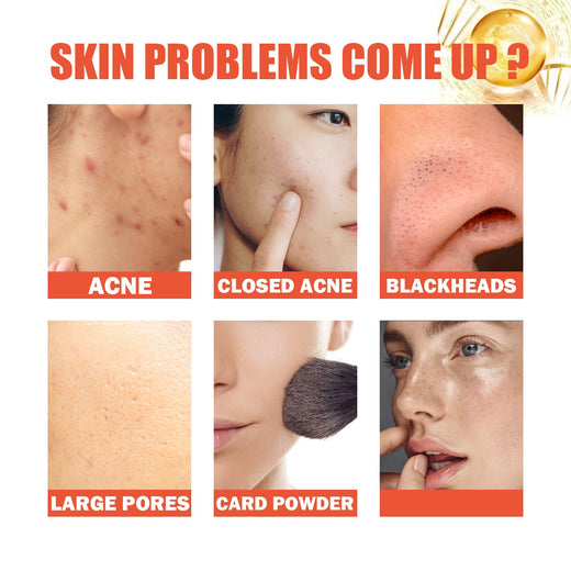 Snail Nourishing Repair Essence – Pimple Treatment & Scar
