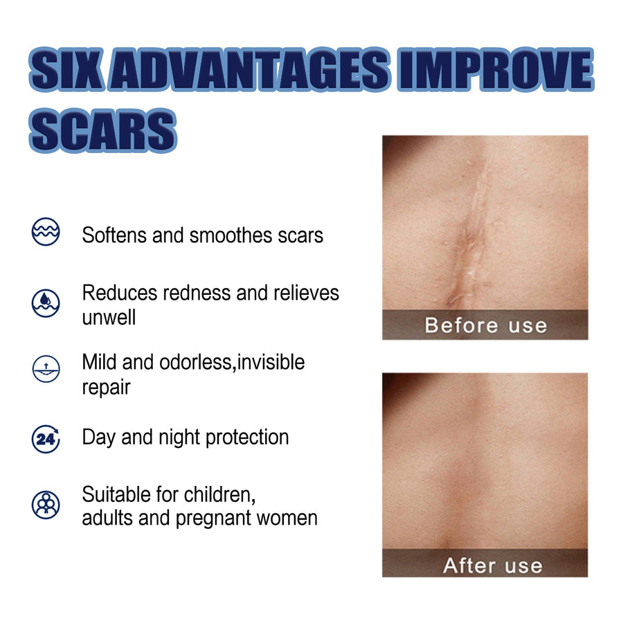 Scar Repair Cream With Dimethicone For Smoother Skin