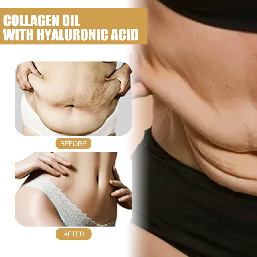 Firming Collagen Oil — Tighter, Defined Body Curves in 4 Weeks