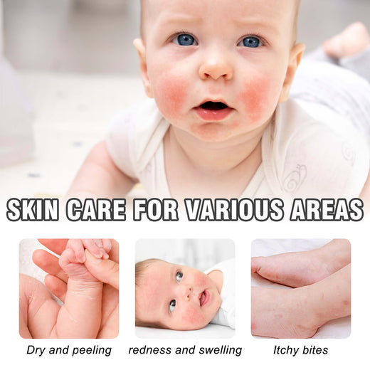 Colloidal Oatmeal Skin Protectant for Redness & Itching