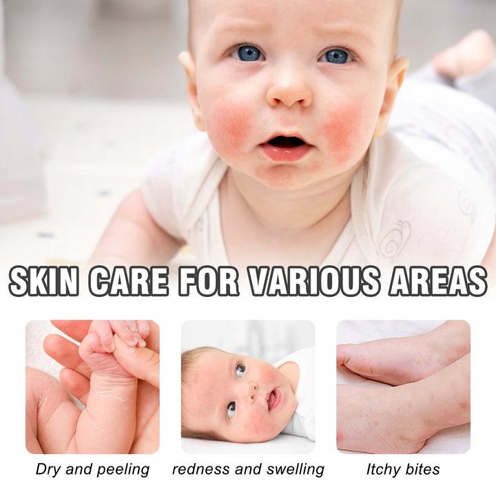 Colloidal Oatmeal Skin Protectant for Redness & Itching