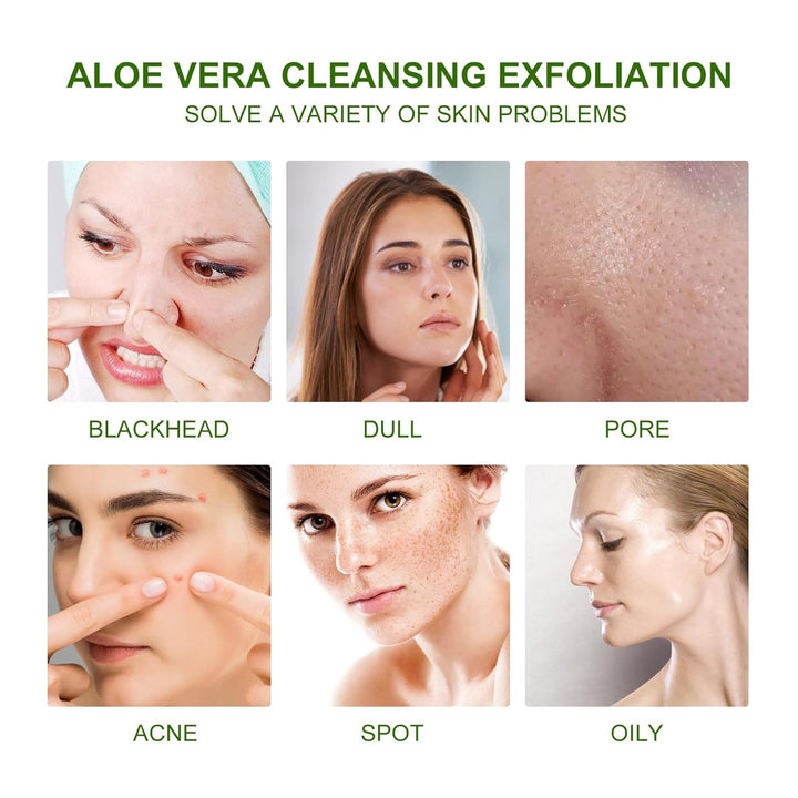Aloe Vera Exfoliating Scrub for Acne Marks & Dull Skin
