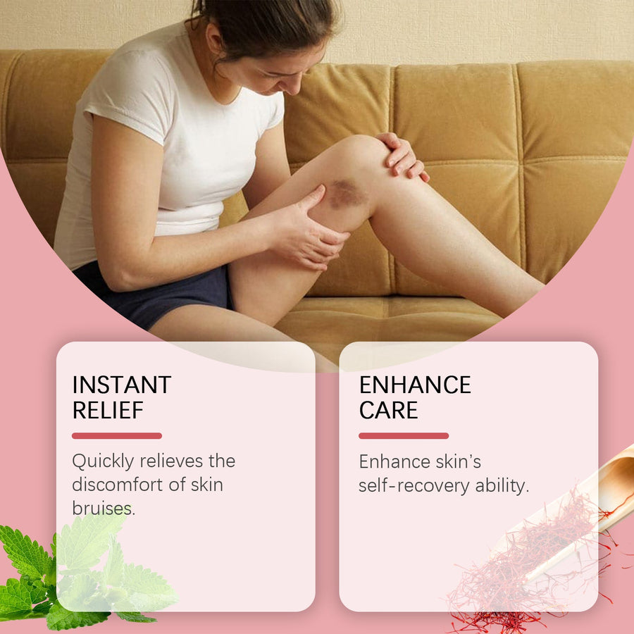 Bruise Relief Spray — Soothe & Heal Bruises Faster
