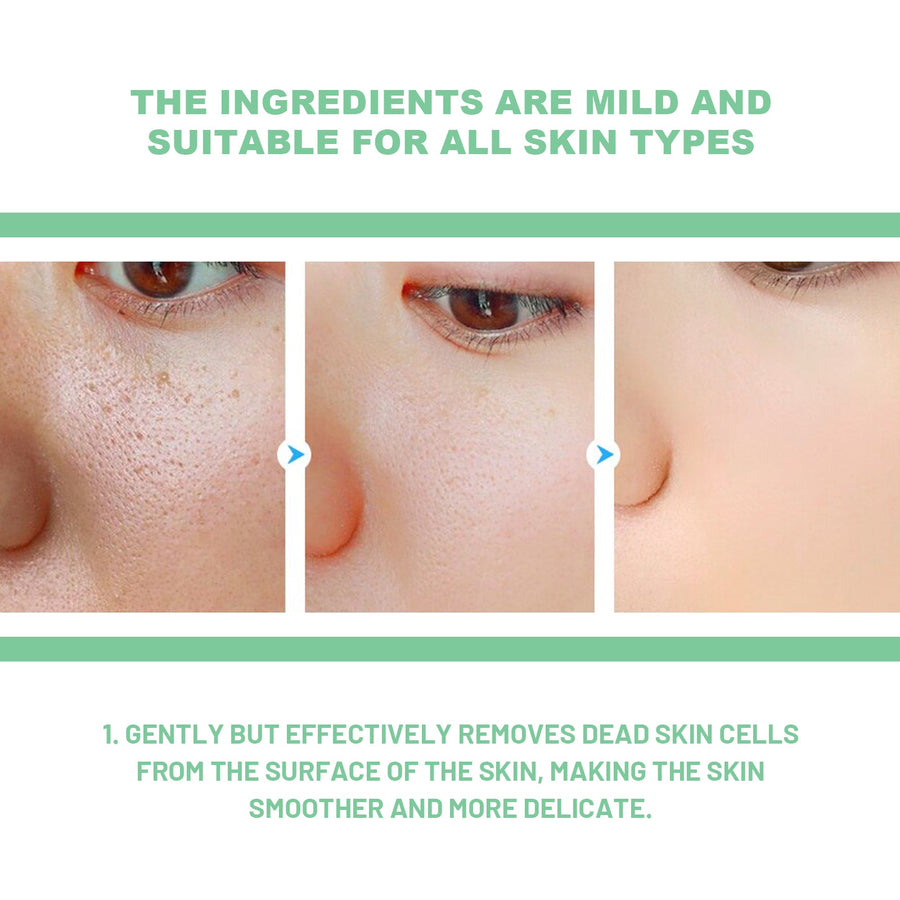 Exfoliating Gel for Bright, Smooth Pores – Herbal Formula