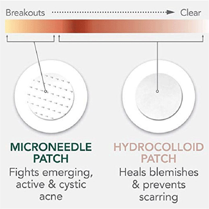 Microneedle Pimple Patch — Clear Pimples in 8 Hours