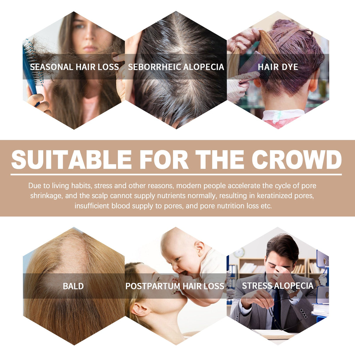 Hair Root Essence for Stronger, Fuller-Looking Hair