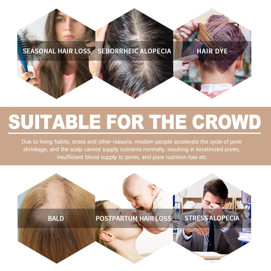 Hair Root Essence for Stronger, Fuller-Looking Hair