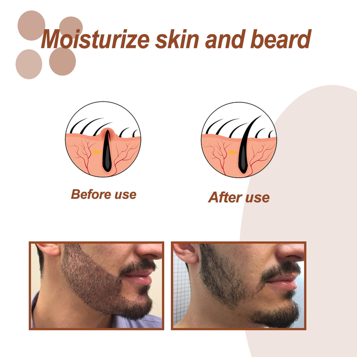 Beard Oil — 100% Plant-Based Moisturizer for Softer
