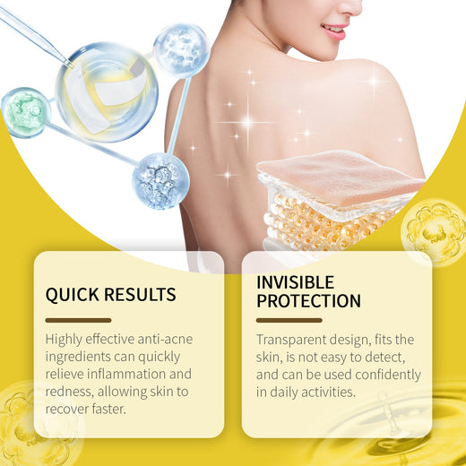 Back Acne Patches with Microdarts for Fast Clearing