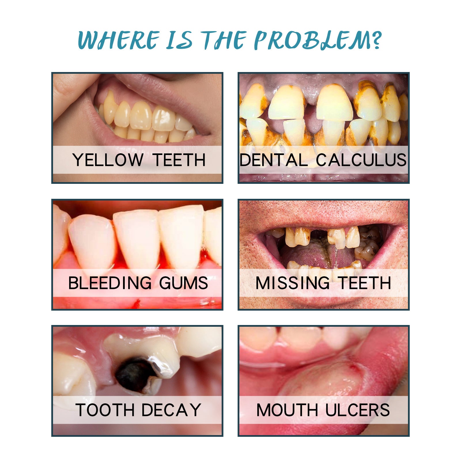 Six-panel grid showing common dental problems: Yellow teeth, Dental calculus, Bleeding gums, Missing teeth, Tooth decay, Mouth ulcers