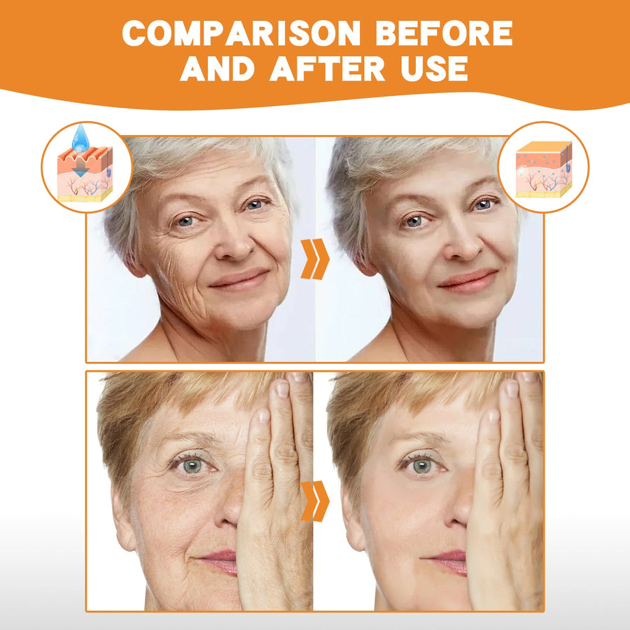 Snail Peptide Collagen Essence Set for Fine Lines