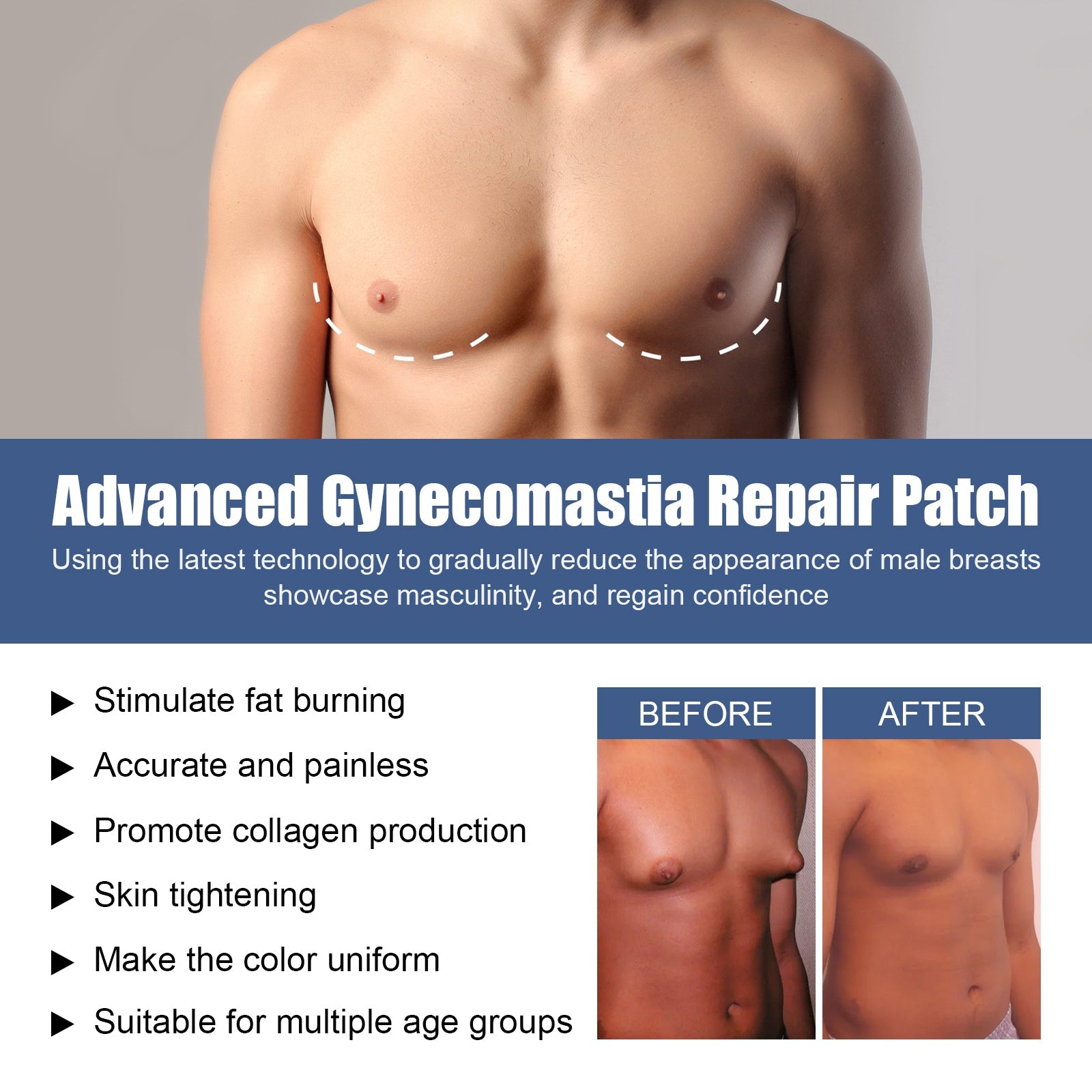 East Moon GynoPatch package showing branded carton with male anatomical reference and contoured white gel patches in blister