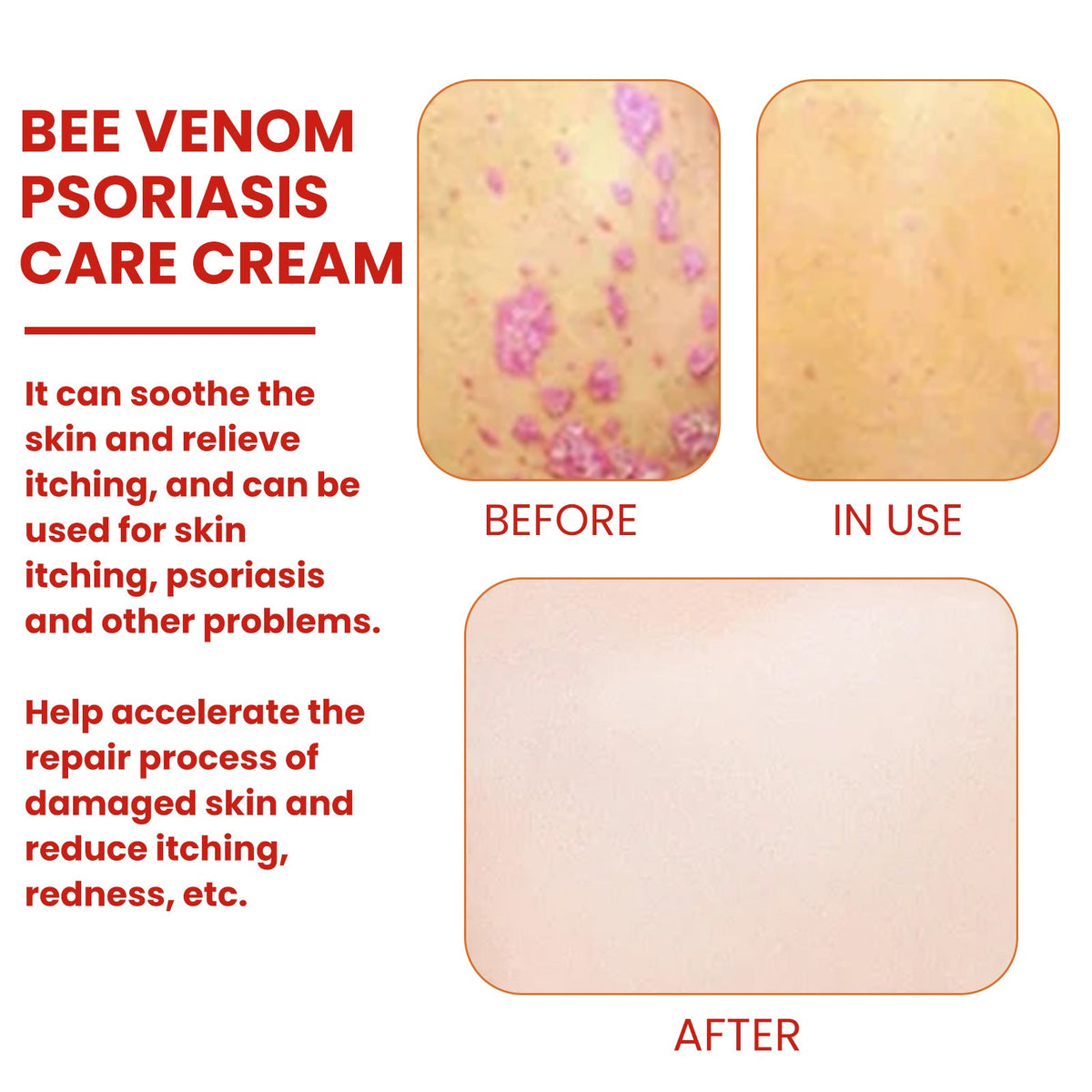 Bee Venom Cream for Daily Skin Care