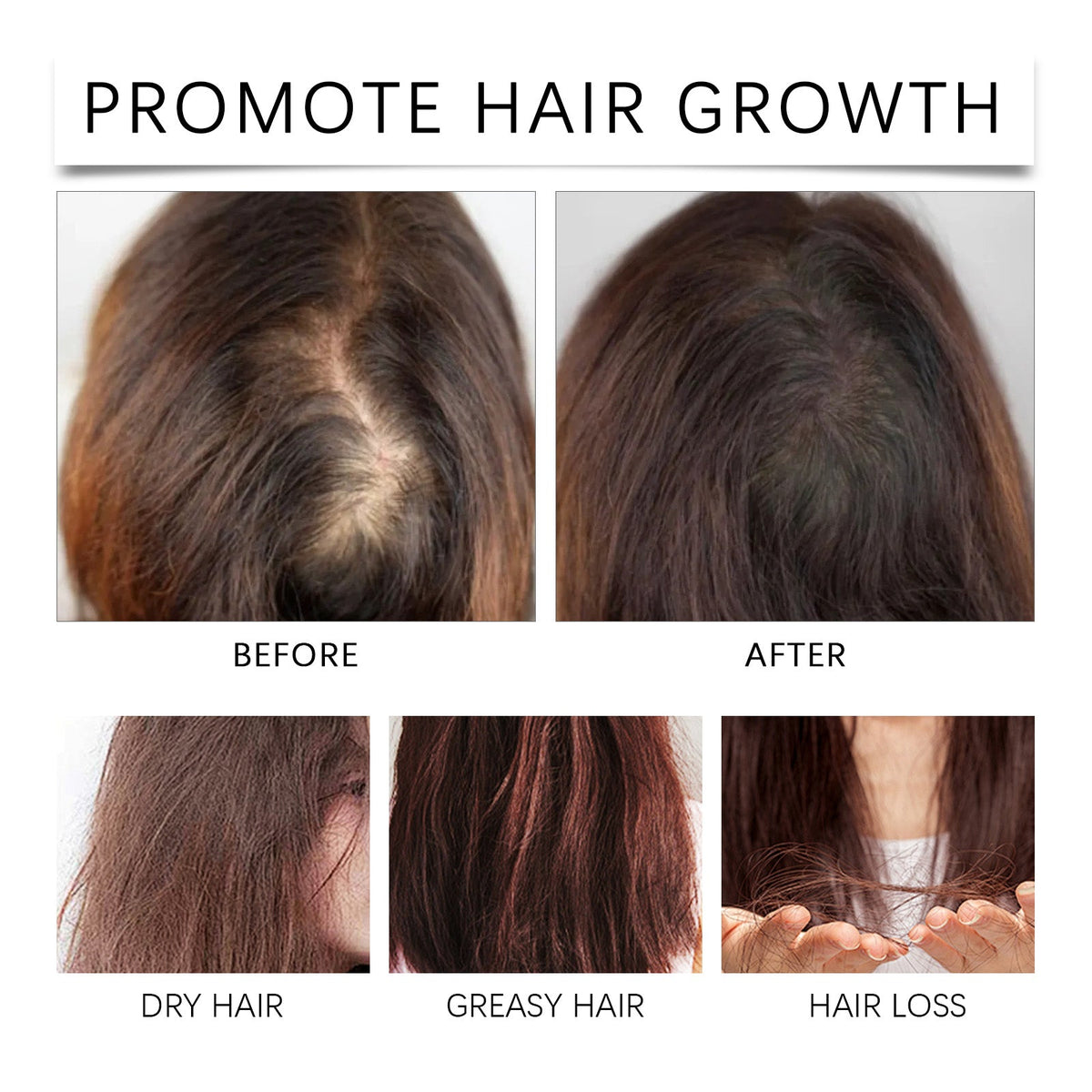 Rosemary Hair Growth Oil for Dry, Fragile Hair Care