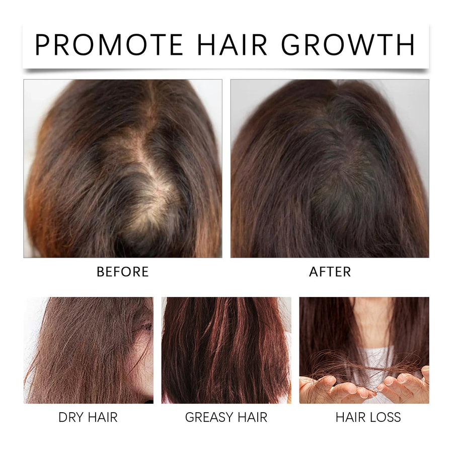 Rosemary Hair Growth Oil for Dry, Fragile Hair Care