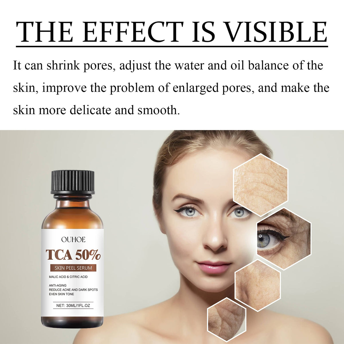 TCA 50 Skin Peel Serum for Wrinkles and Dark Spots