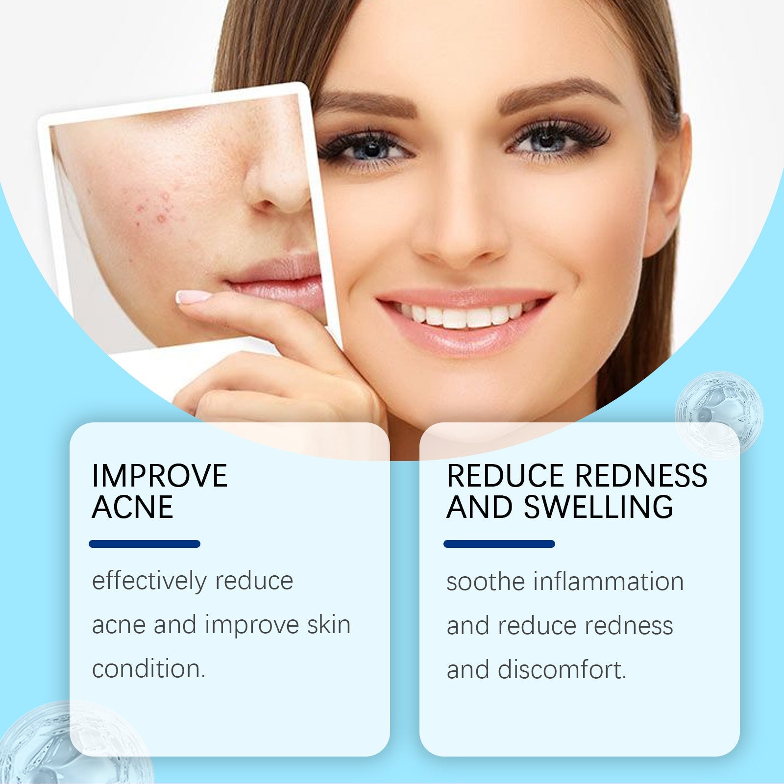 Split image showing acne-prone skin with visible blemishes on left transitioning to clear complexion on right, with benefit callouts for acne improvement and redness reduction