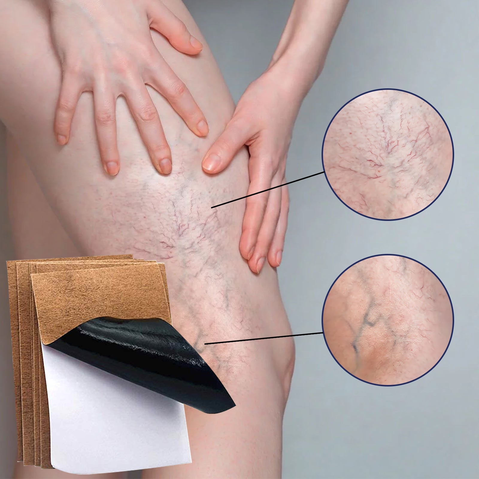 Person applying or wearing the tan herbal patch on leg showing real-world application, with close-up before/after comparison showing reduction in vein appearance
