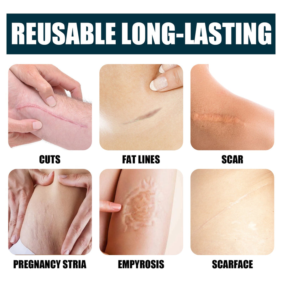 Scar Care Gel for Smoother, Hydrated-Looking Skin