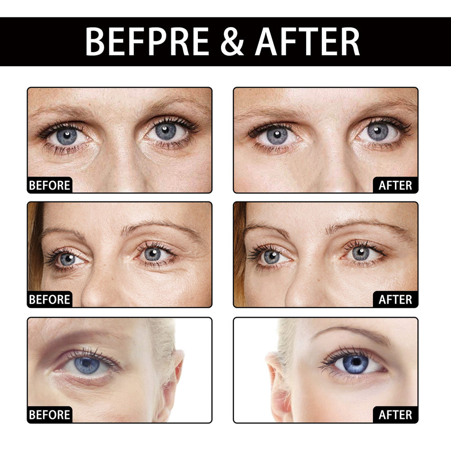 Coconut Eye Gel Patches for Hydration & Fine Lines
