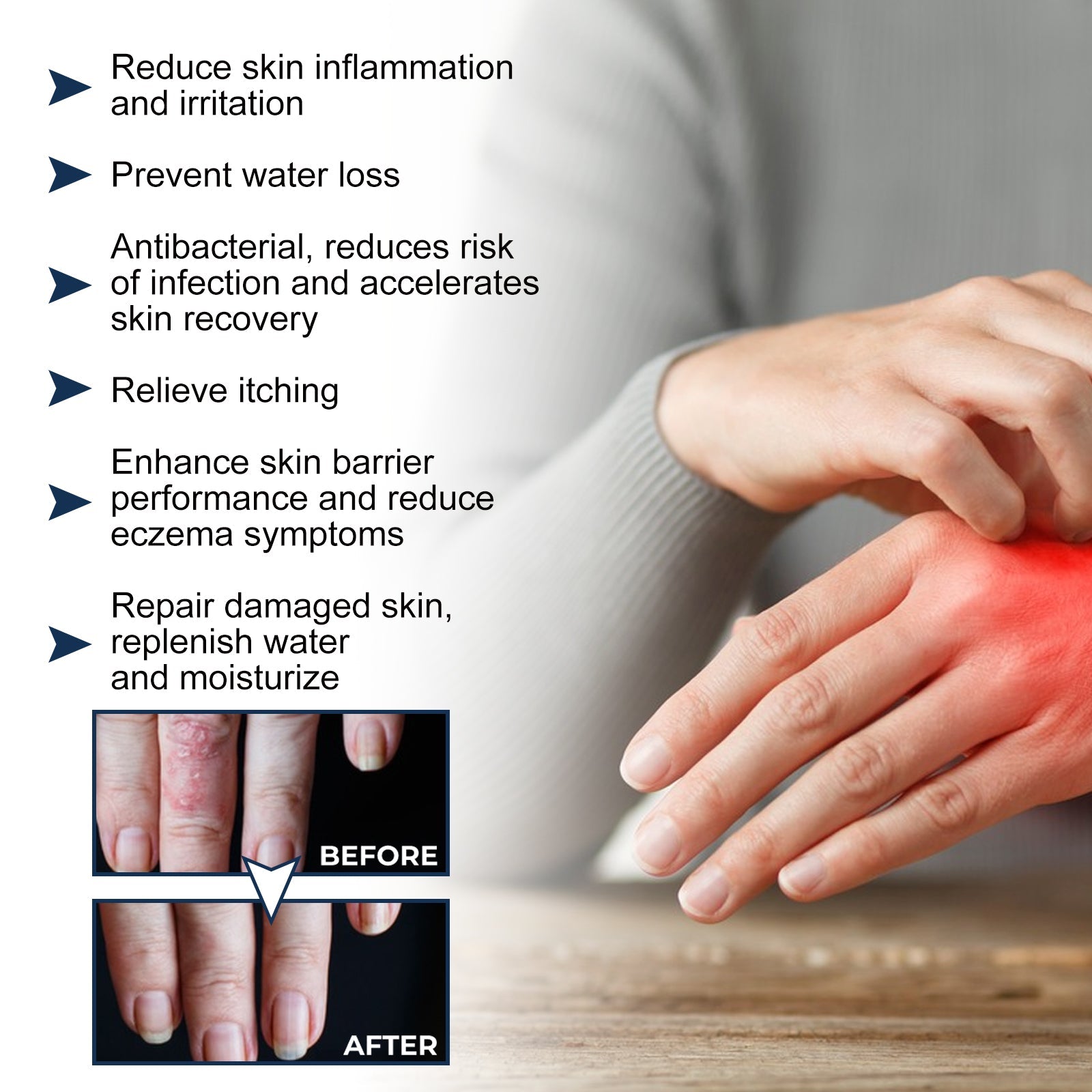 Clinical before-and-after comparison with benefit bullets and skin condition results on hands and wrist area