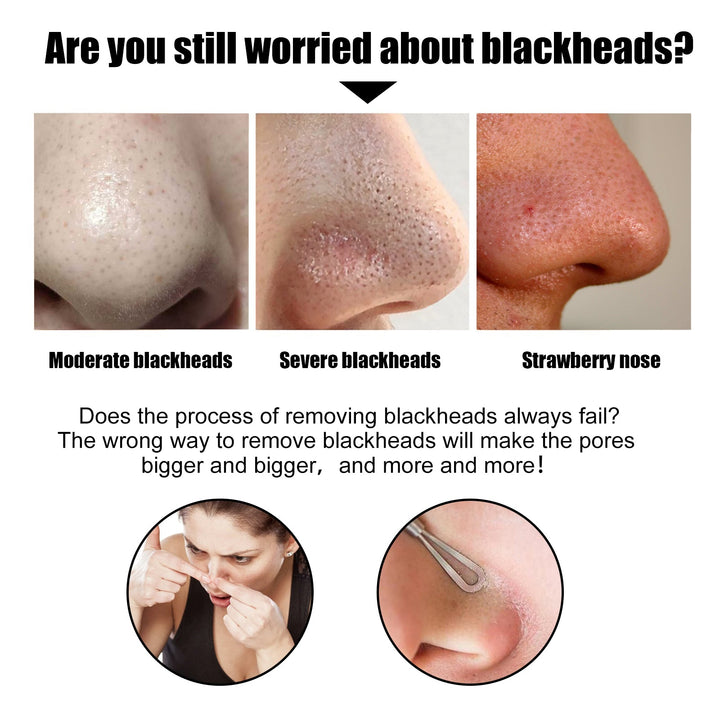 Bamboo Charcoal Nose Pore Strips for Blackhead Removal