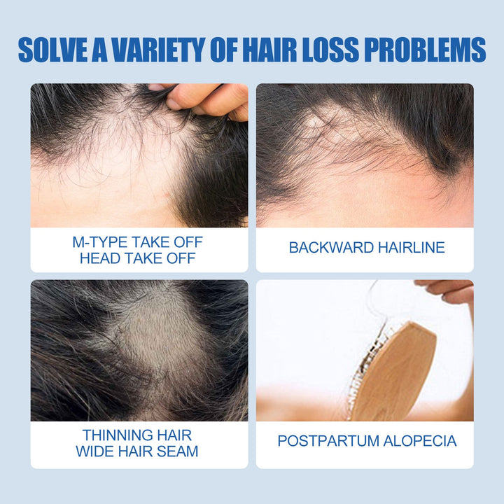5% Minoxidil Hair Regrowth Treatment for Men, 60ml