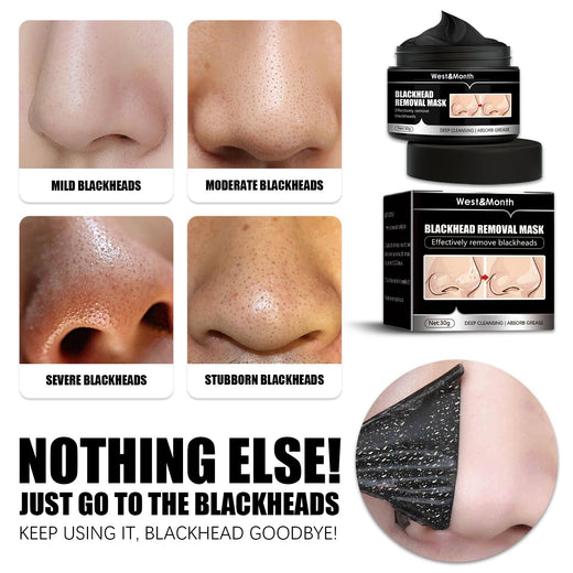Blackhead Removal Mask — Activated Charcoal Peel‑Off Deep
