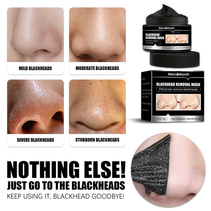 Blackhead Removal Mask — Activated Charcoal Peel‑Off Deep