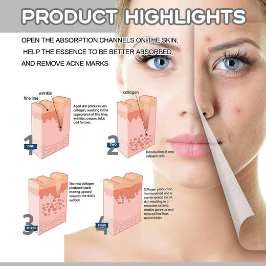 Microneedle Face Roller for Fine Lines & Acne Marks