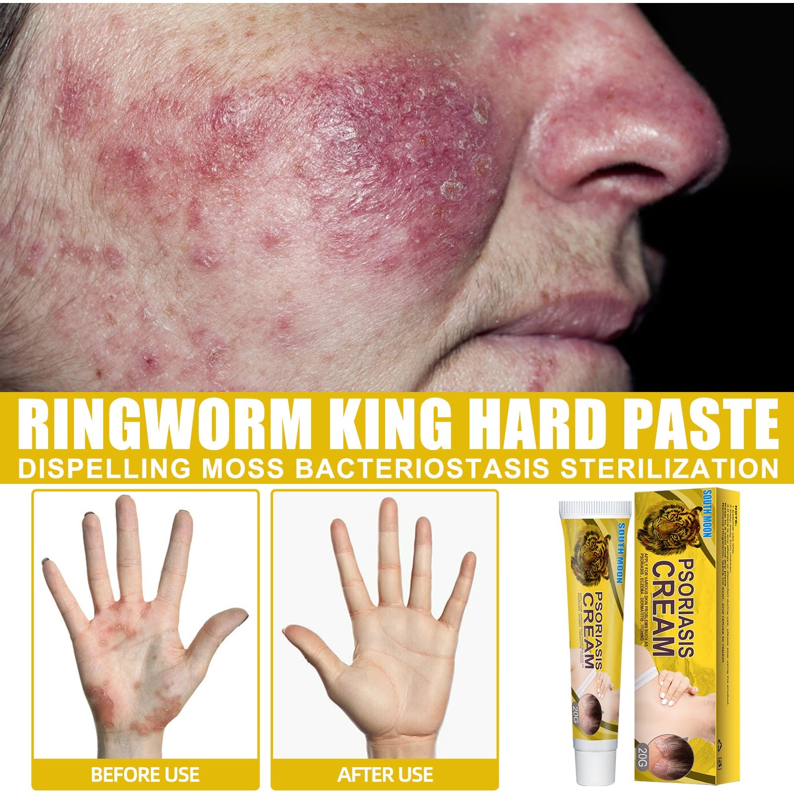 Close-up of arm showing dry, flaking, irritated skin with visible dermatitis symptoms and text overlay listing conditions treated