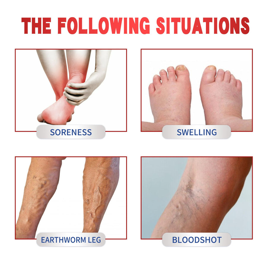 Varicose Vein Patch — 24-Hour Herbal Relief for Leg