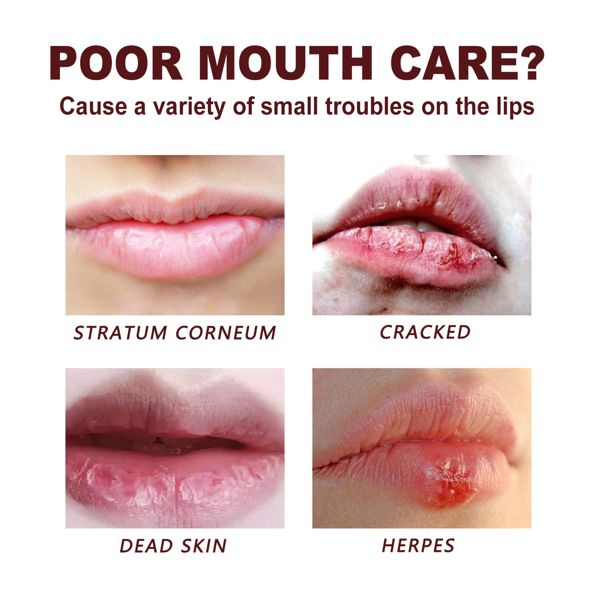 Lip Repair Cream for Chapped Lips & Cold Sore Relief
