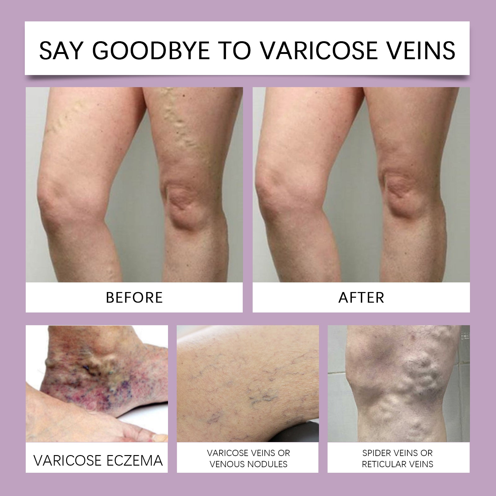 Smooth, well-moisturized leg with text overlay 'DEEPLY MOISTURIZE THE SKIN' and benefit statement about relieving leg fatigue