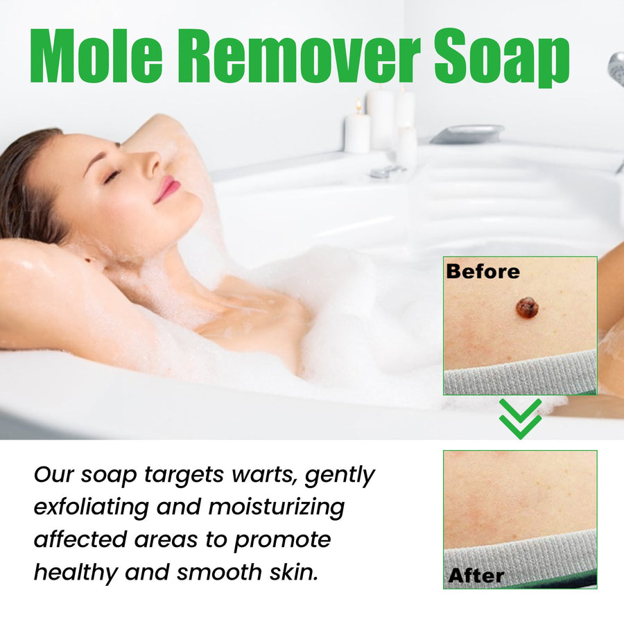 Mole Remover Soap — Painless, Scar-Free Wart & Blemish Removal