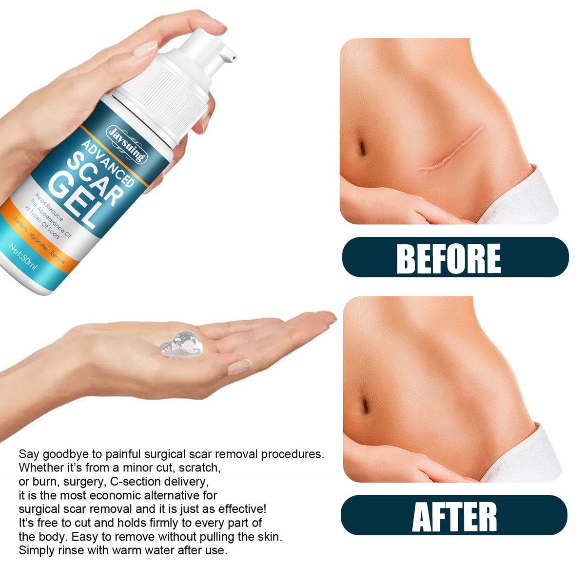 Scar Care Gel for Smoother, Hydrated-Looking Skin