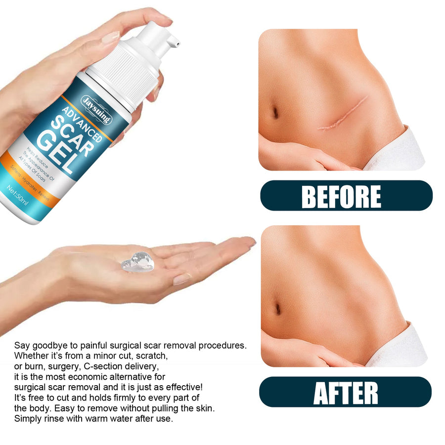 Scar Care Gel for Smoother, Hydrated-Looking Skin