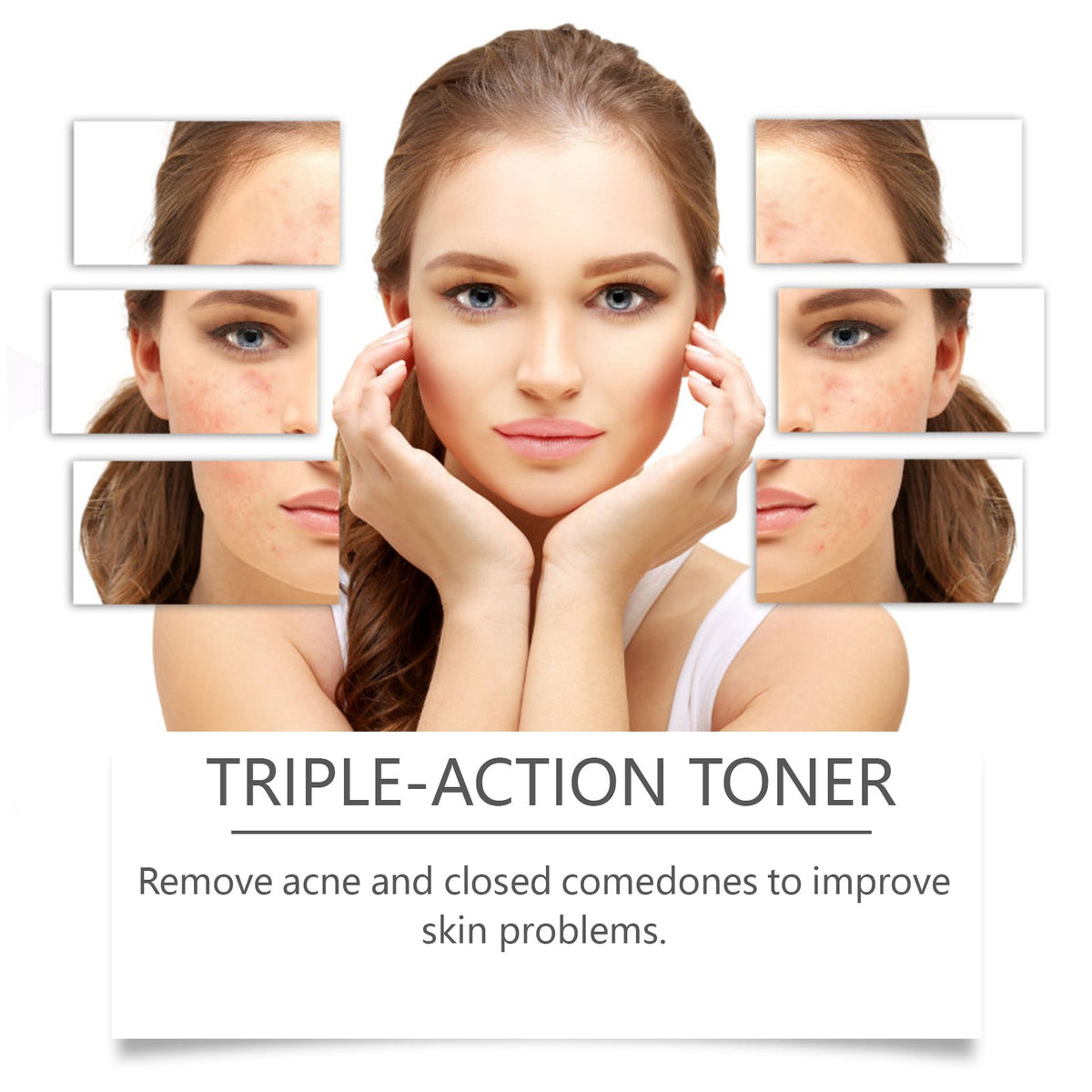 Cucumber Toner That Calms Acne Before It Starts