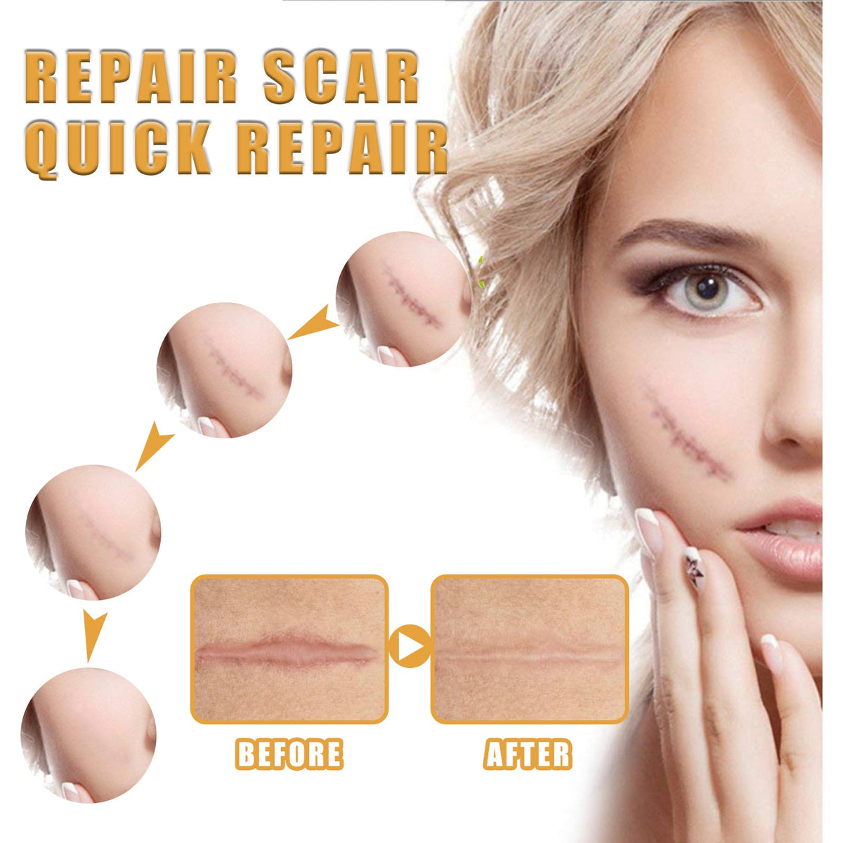 Scar Repair Cream — Fades Scars & Restores Smooth Skin