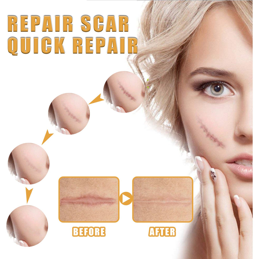 Scar Repair Cream — Fades Scars & Restores Smooth Skin