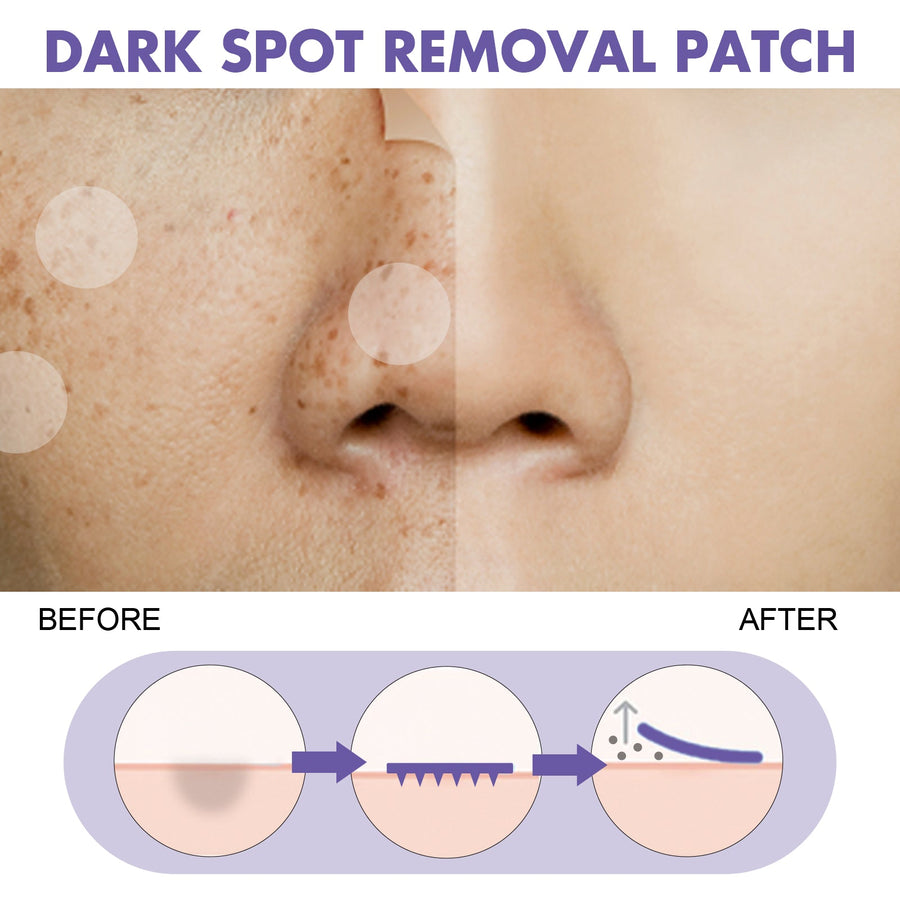 Dark Spot Patch for Melasma & Hyperpigmentation, 144ct