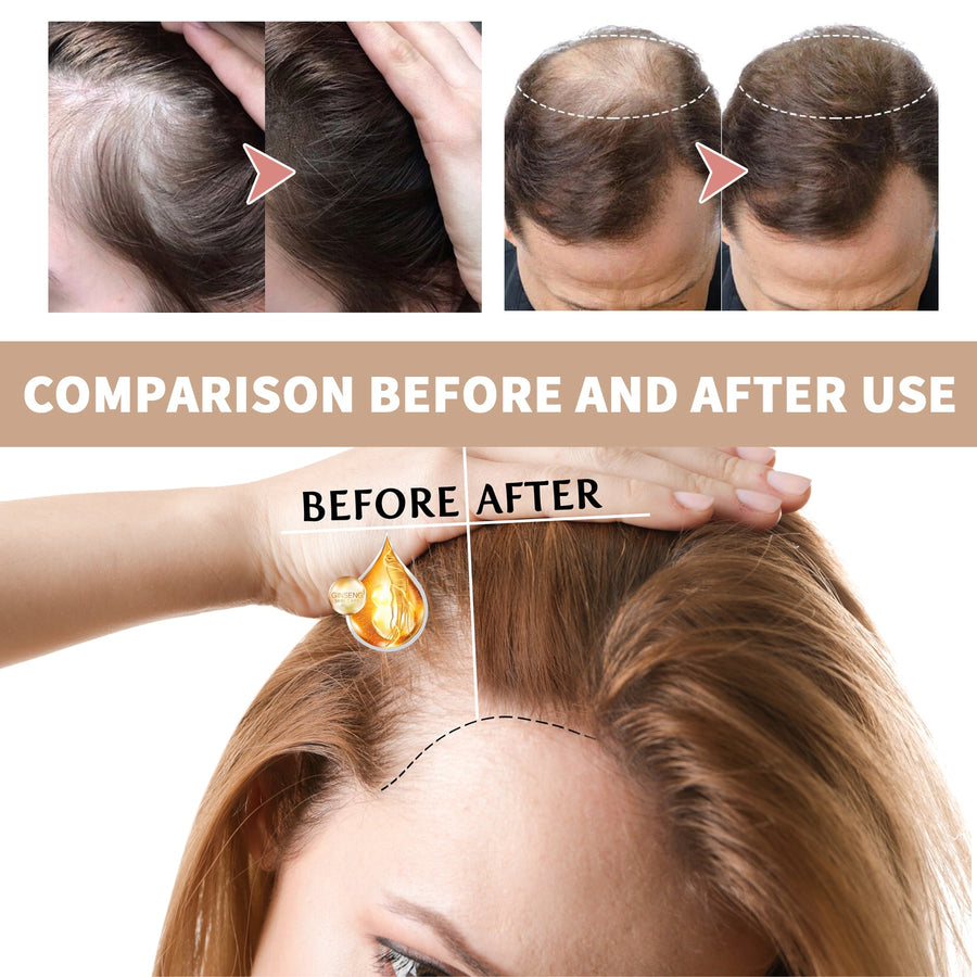 Hair Root Essence for Stronger, Fuller-Looking Hair
