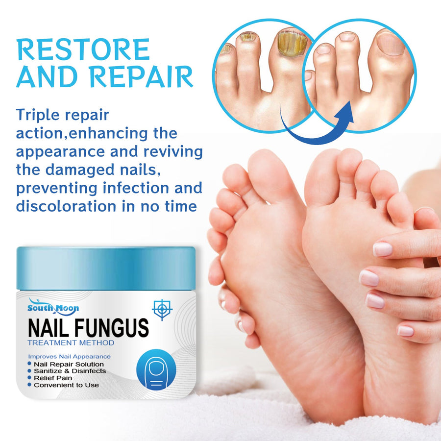 Nail Fungus Treatment Cream — Visible Results in Weeks