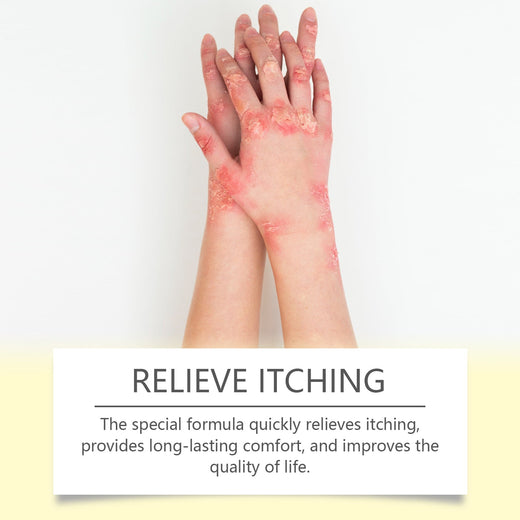Bee Venom Skin Repair Cream for Psoriasis & Eczema