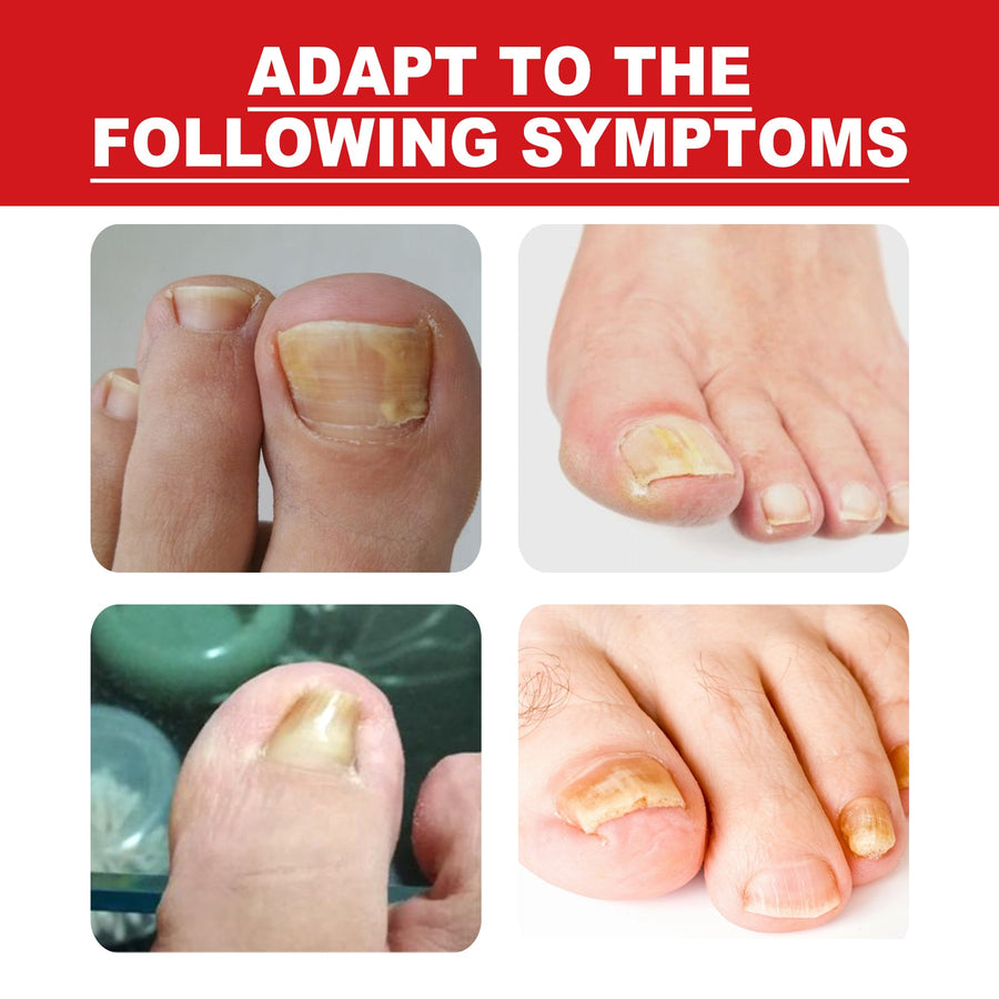 Toenail Repair Essence for Ingrown Nail Pain Relief