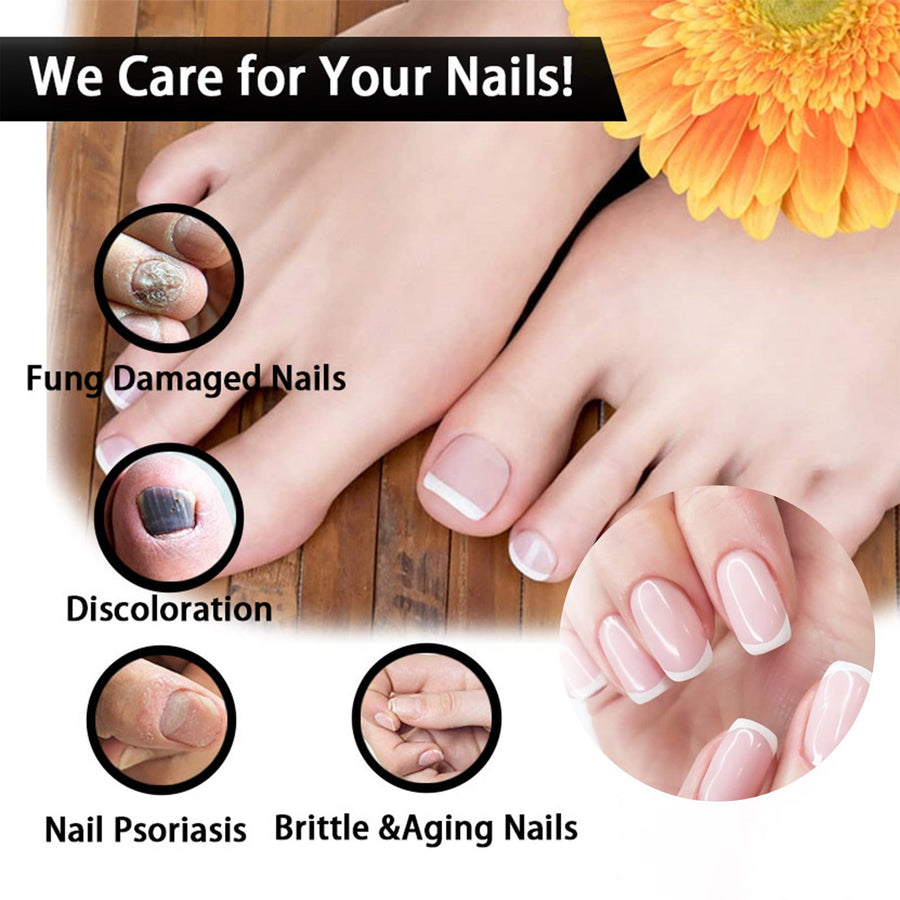Nail Fungus Treatment Oil — Clear, Healthy Nails in 8 Weeks