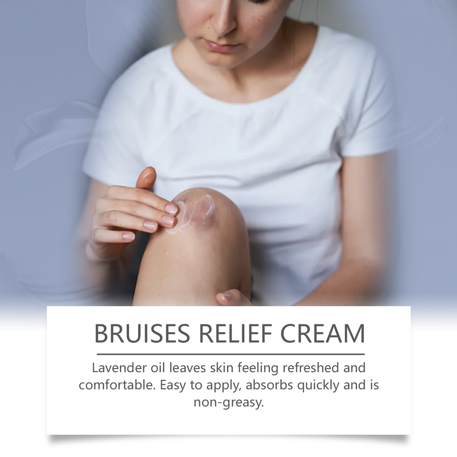 South Moon Bruises Relief Cream — Fade Bruises Faster