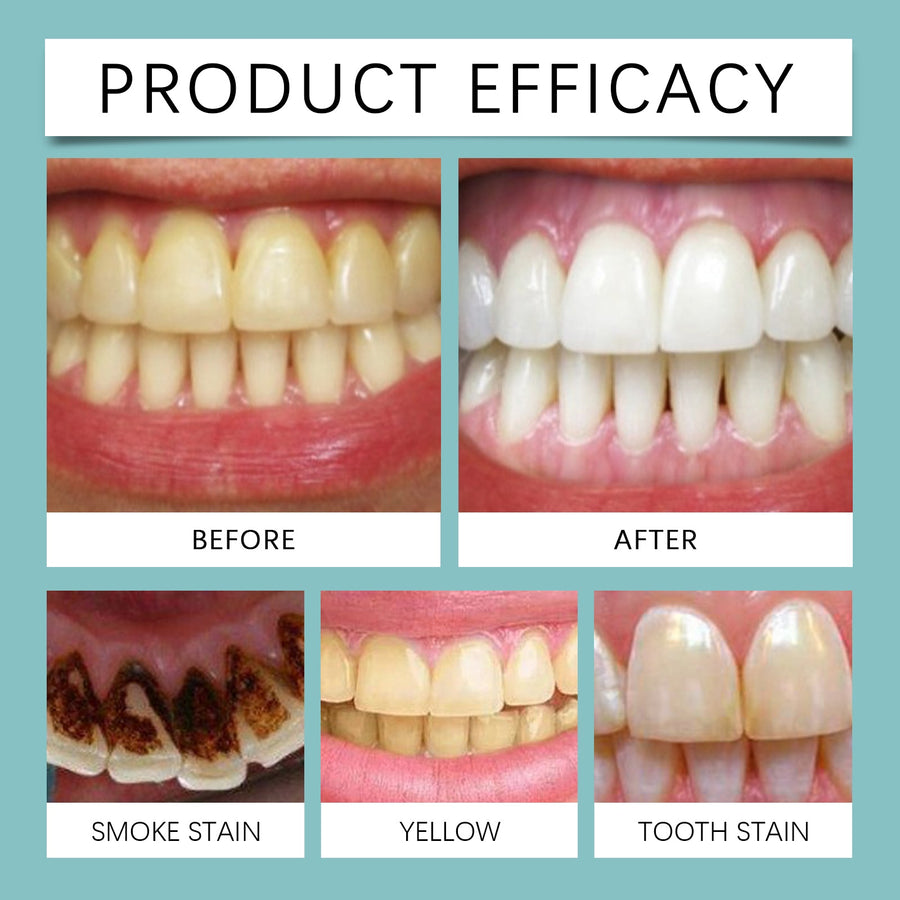 Teeth Whitening Paint – Instant 10-Second Stain Removal