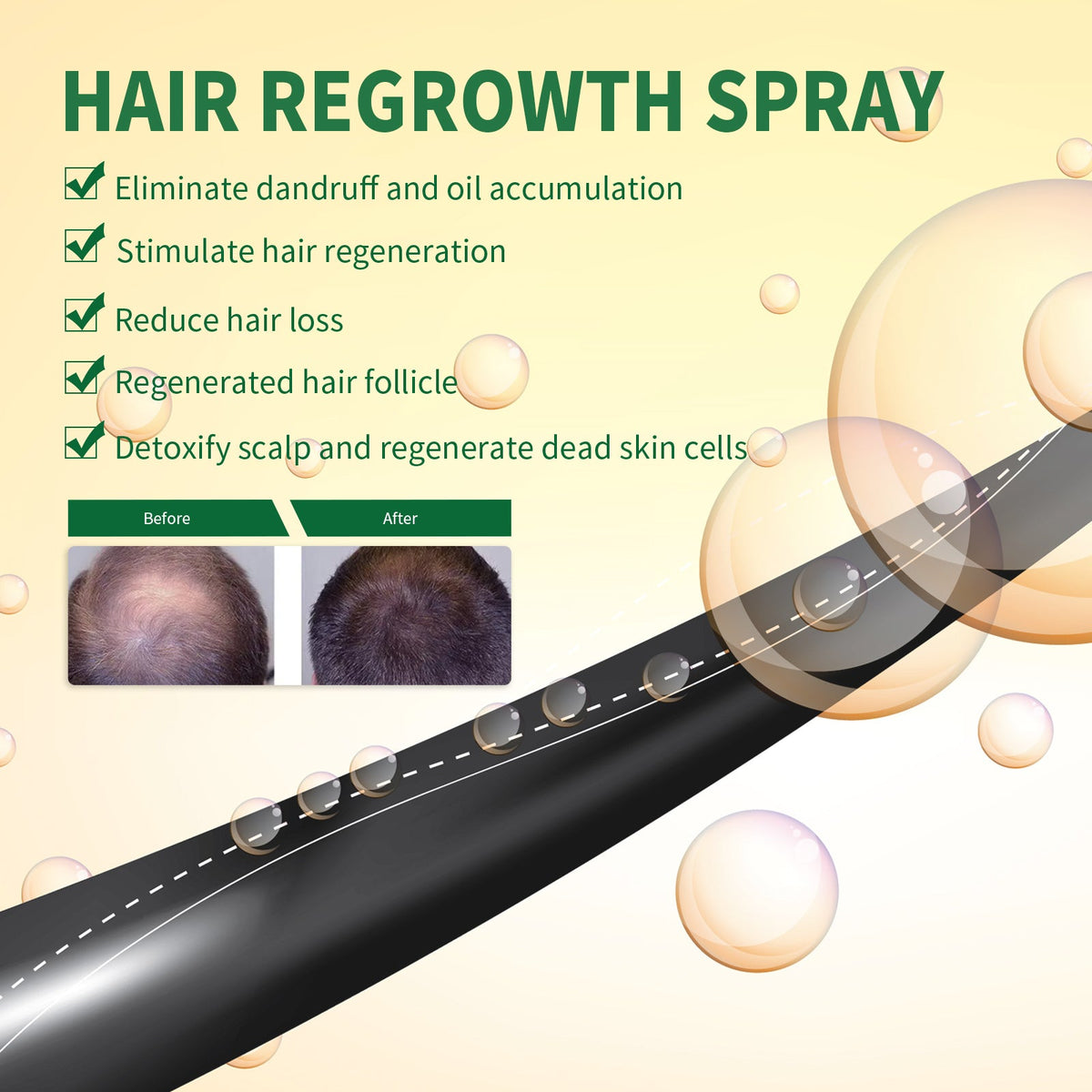 Hair Regrowth Spray — Thickens & Repairs Damaged Follicles